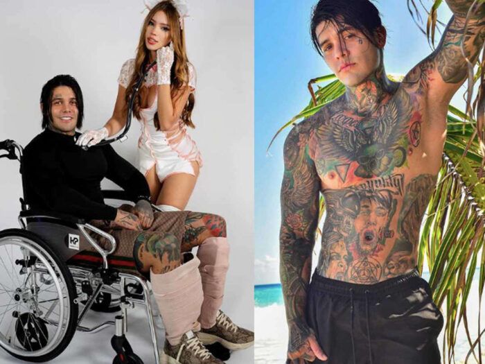 Influencer Yeferson Cossio gasta miles de dólares para alargar sus piernas con doloroso resultado